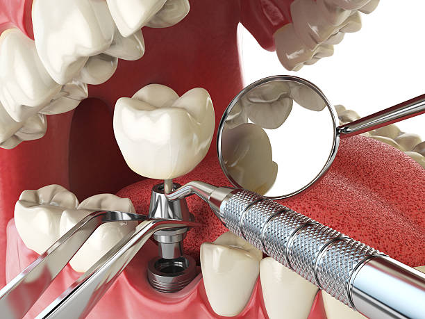 Best Broken Tooth Emergency  in Rolling Hills, CA